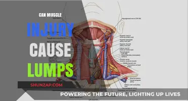 Muscle Injuries: Lumps, Causes, and Treatment