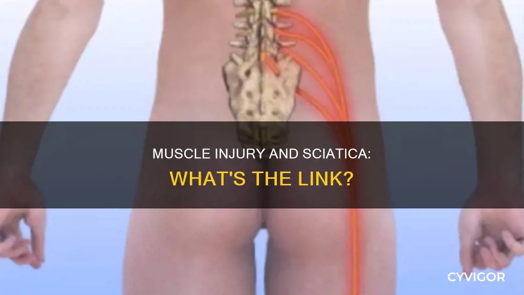 can muscle injury cause sciatica