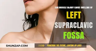 Muscle Injuries: Swelling in the Left Supraclavicular Fossa