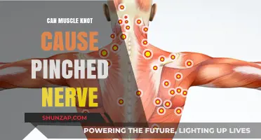 Muscle Knots: A Cause of Pinched Nerves?