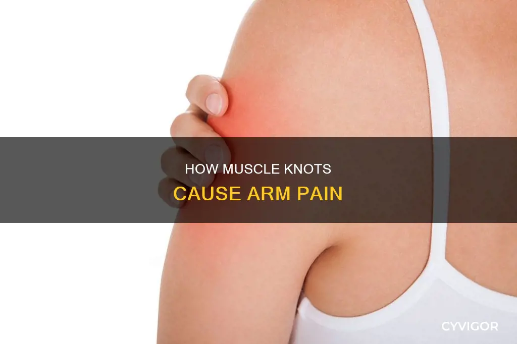 can muscle knots cause arm pain