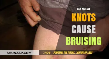 How Muscle Knots Cause Bruising and Pain