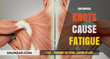 Muscle Knots and Fatigue: What's the Connection?