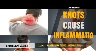 Muscle Knots: Do They Cause Inflammation?