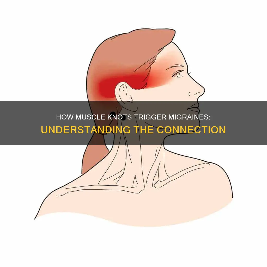 can muscle knots cause migraines
