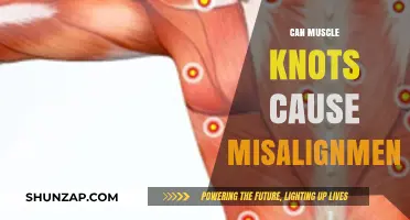 Muscle Knots and Misalignment: What's the Connection?