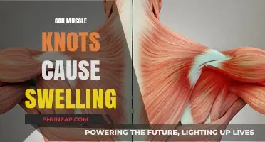Muscle Knots: Can They Cause Swelling and Inflammation?