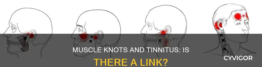 can muscle knots cause tinninitus