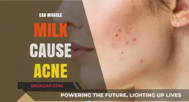 Muscle Milk and Acne: Is There a Link?