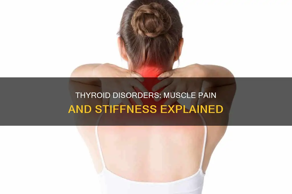 can muscle pain and stiffness be caused by thyroid