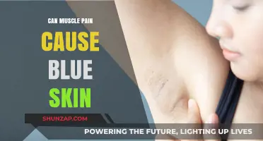 Mysterious Muscle Pain and Blue Skin: What's the Link?