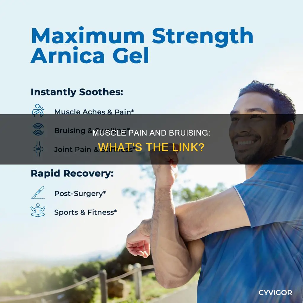can muscle pain cause bruising