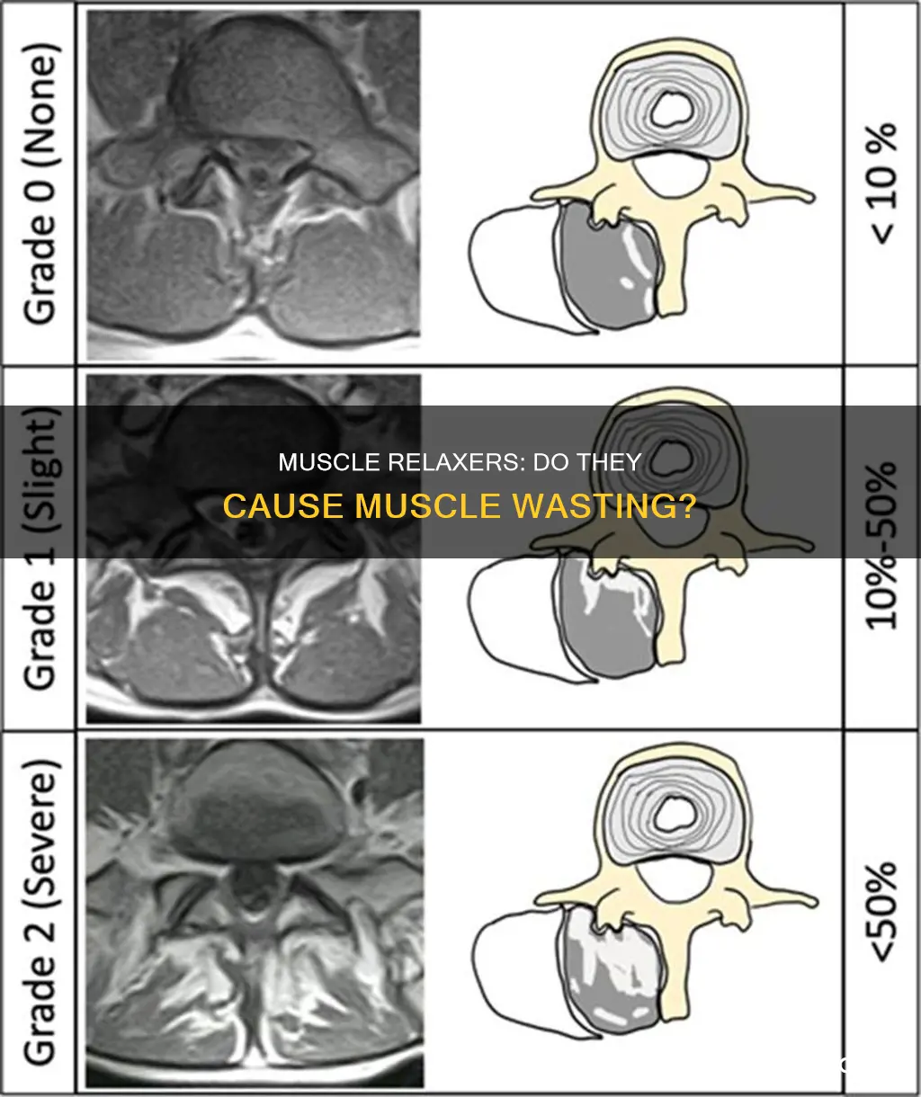 can muscle relaxers cause muscle wasting