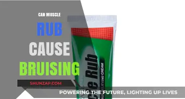 Muscle Rub: Can It Cause Bruising?