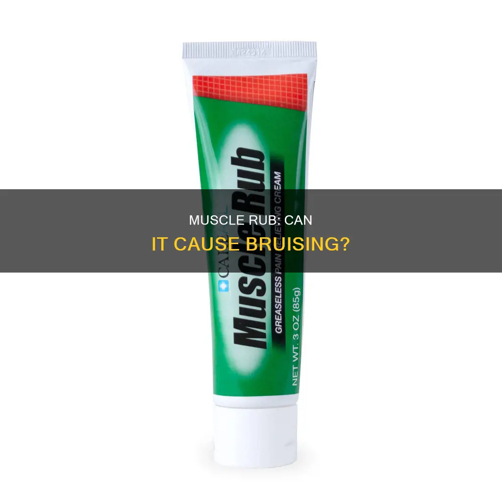 can muscle rub cause bruising