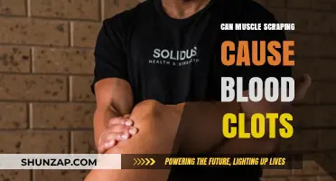 Muscle Scraping: Blood Clot Risk and Prevention