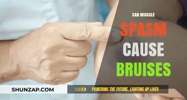Muscle Spasms: Can They Cause Bruising?