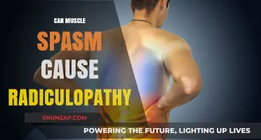 Muscle Spasms: A Root Cause of Radiculopathy?