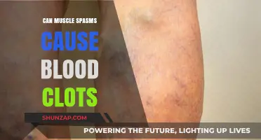 Muscle Spasms: A Surprising Cause of Blood Clots?