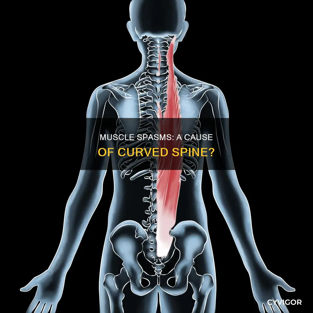 can muscle spasms cause curved spine
