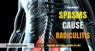 Muscle Spasms: A Radiculitis Trigger?