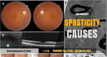 Understanding the Root Causes of Muscle Spasticity