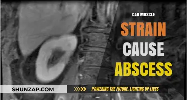 Muscle Strain Abscess: What's the Link?