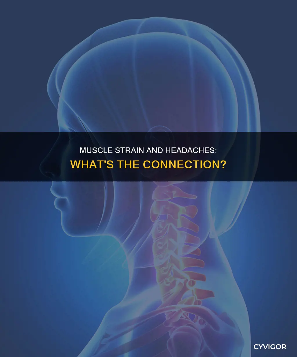 can muscle strain cause headaches