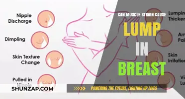 Muscle Strain and Breast Lumps: What's the Link?
