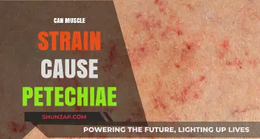 Muscle Strain and Petechiae: What's the Link?