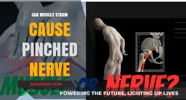 Muscle Strain: A Cause of Pinched Nerves?