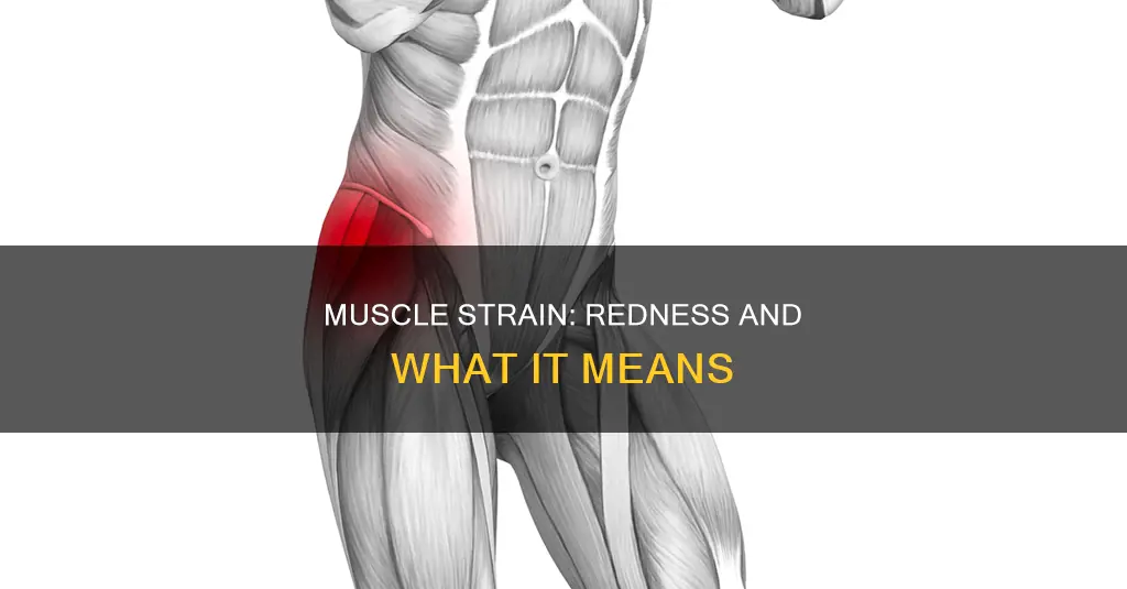 can muscle strain cause redness