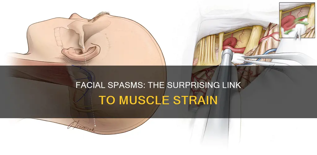 can muscle strain cause spasms in face