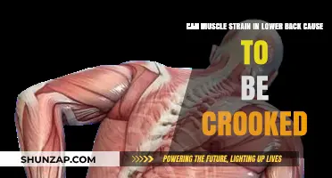Back Pain: Crooked Posture from Strained Muscles