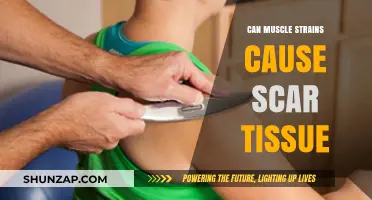 Muscle Strains: How Scar Tissue Forms and Heals