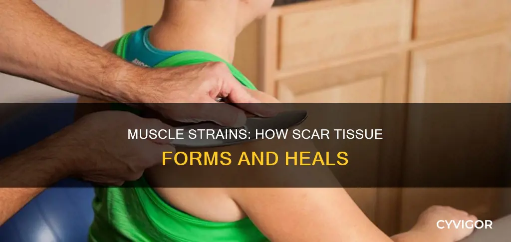 can muscle strains cause scar tissue