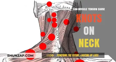 How Muscle Tension Creates Neck Knots