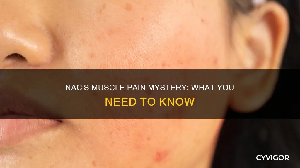 can nac cause muscle pain