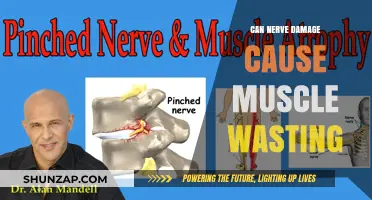 Nerve Damage and Muscle Wasting: What's the Link?