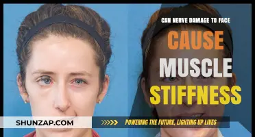 Facial Nerve Damage: Can it Cause Muscle Stiffness?