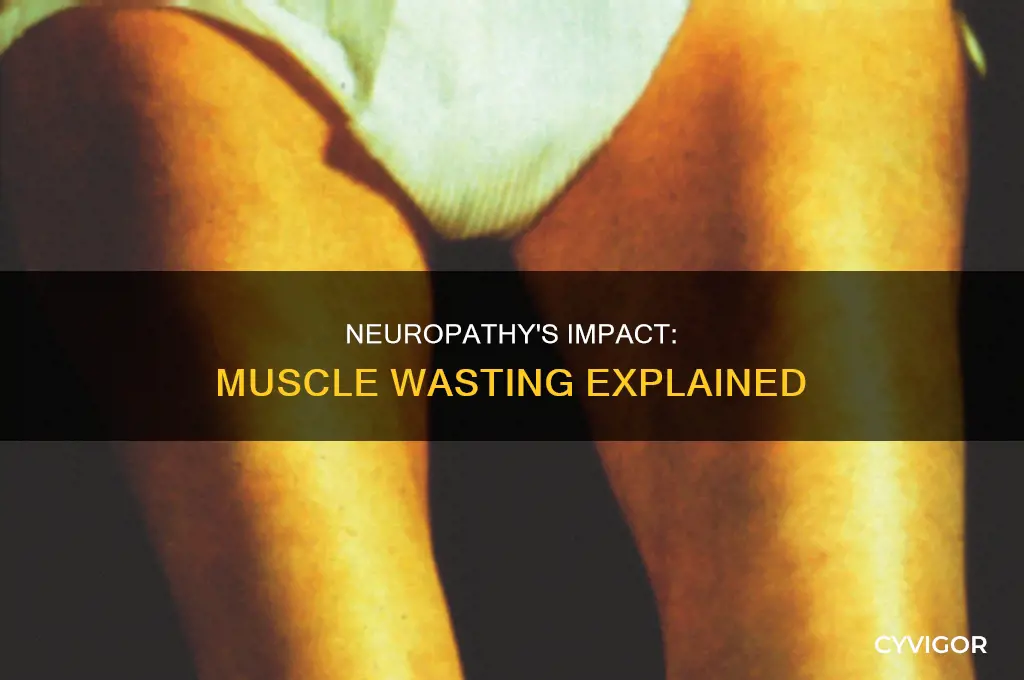 can neuropathy cause muscle wasting