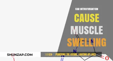 Nitrofurantoin's Uncommon Side Effect: Muscle Swelling
