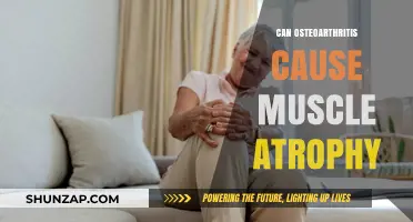 Osteoarthritis and Muscle Atrophy: What's the Link?