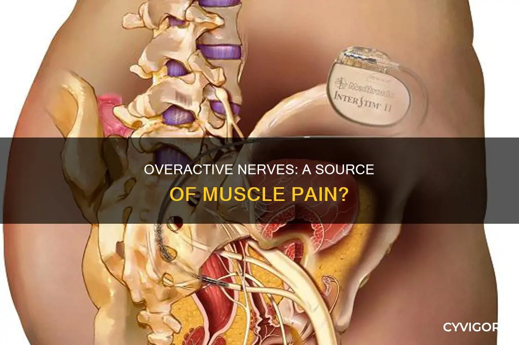 can over active nerves in muscles cause pain