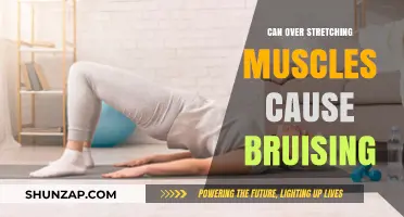 Overstretching Muscles: Bruising and Its Prevention