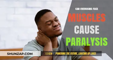 Facial Paralysis: Overusing Muscles a Concern?