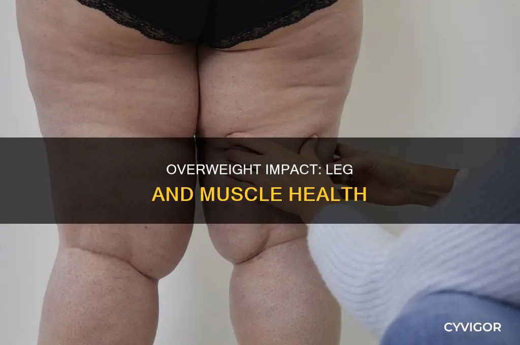 can overweight cause your legs and muscles to get bad