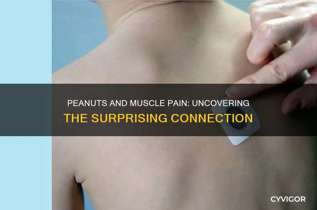 can peanuts cause muscle pain