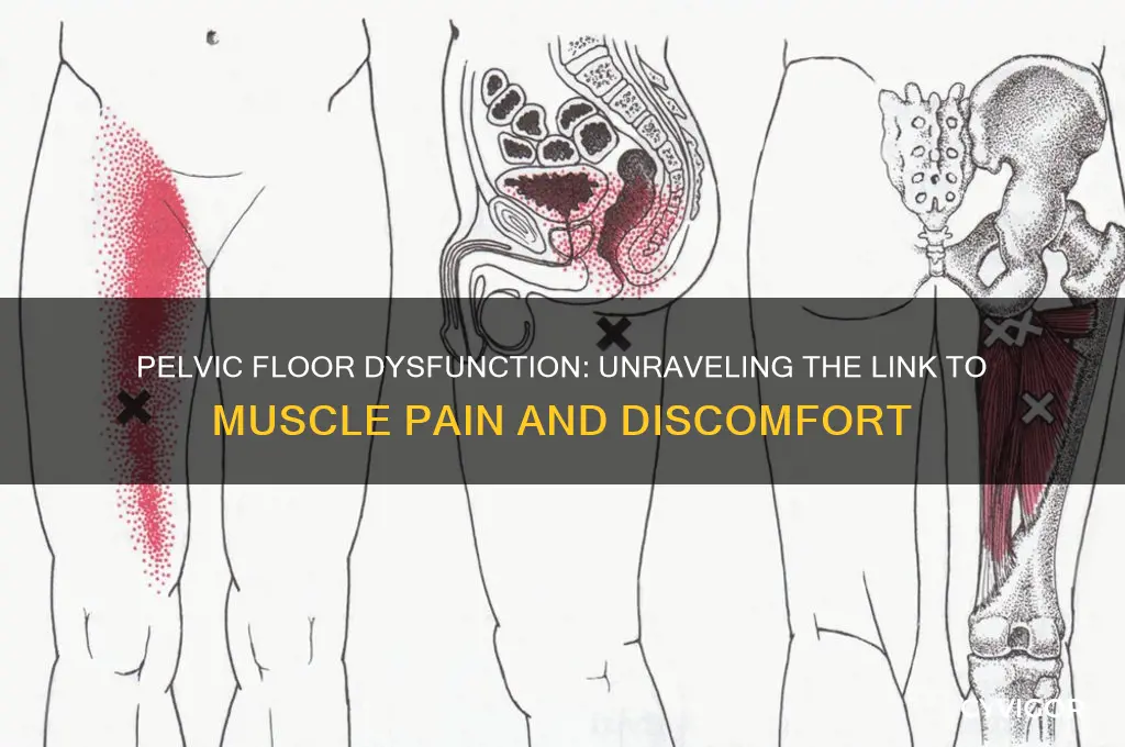 can pelvic floor cause muscle pain