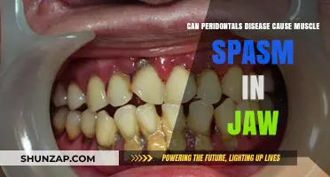 Periodontal Disease and Jaw Muscle Spasms: Uncovering the Potential Link